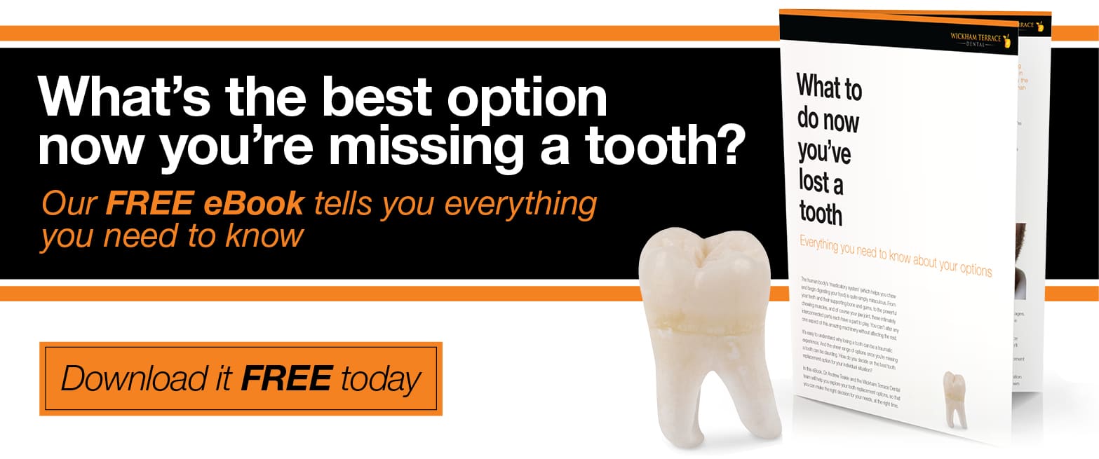 Tooth implant-eBook_CTA