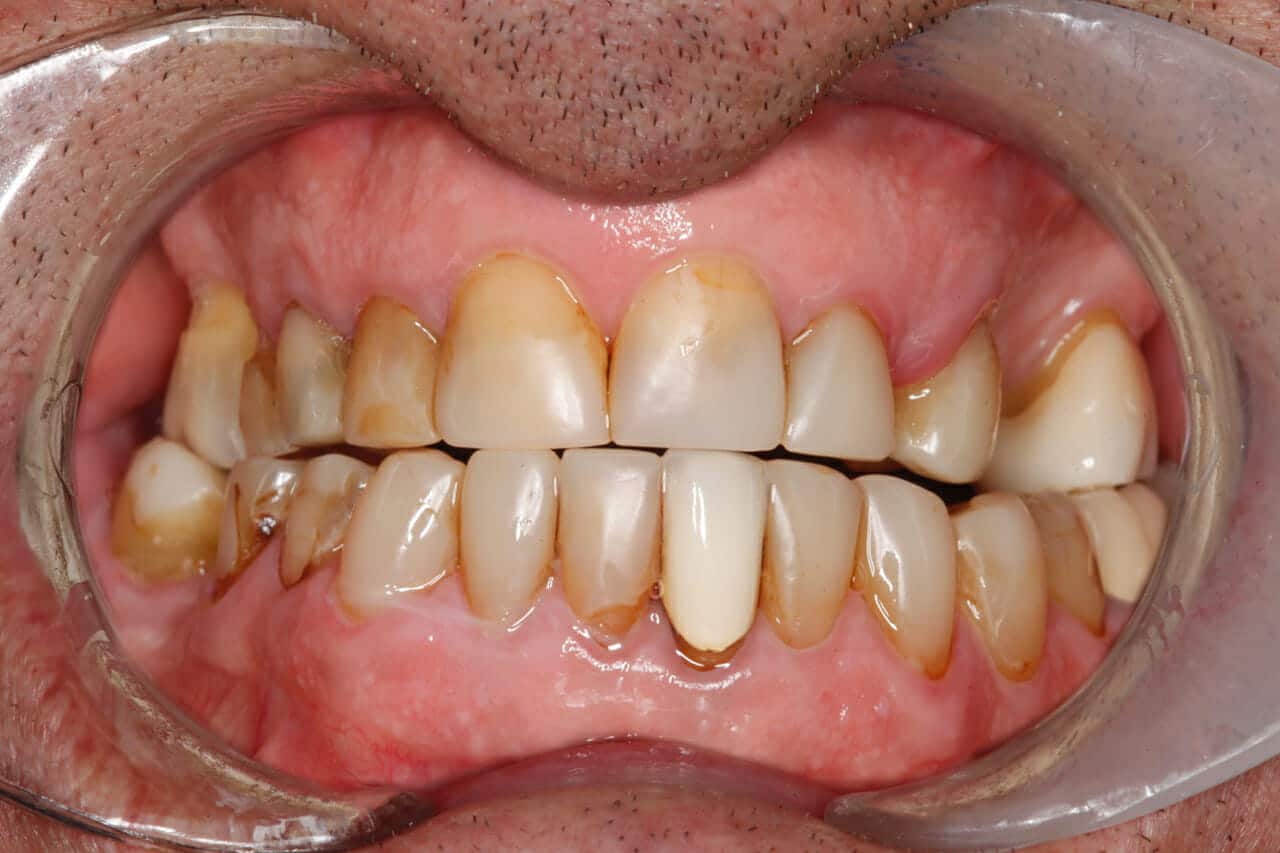 Description of image